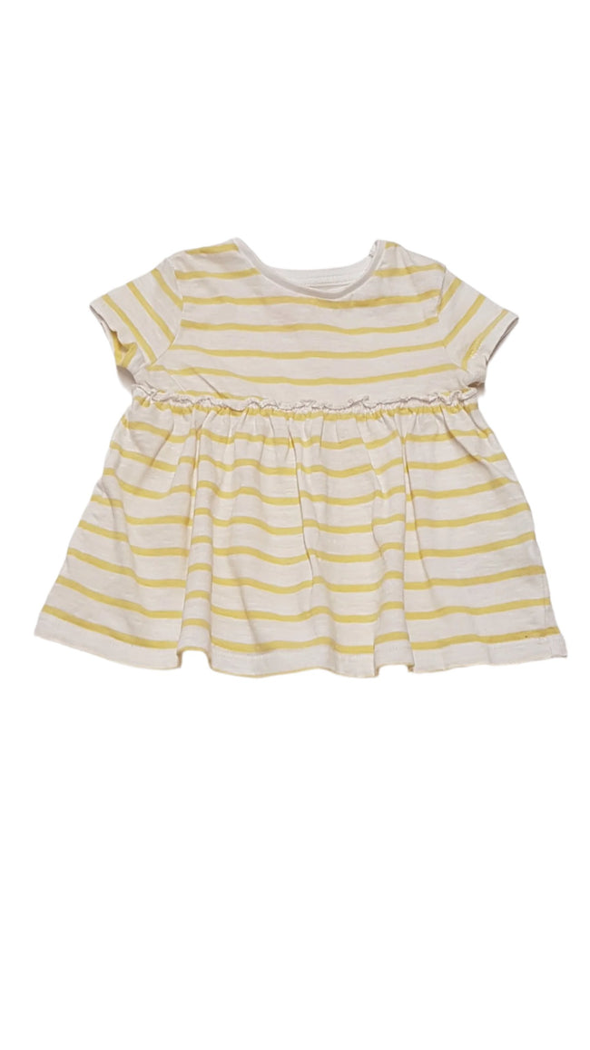 F&F KIDS SÁRGA CSÍKOS KISLÁNY TUNIKA FELSŐ 86 Hover Image